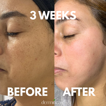 Gluvex Glutathione Oral Liquid